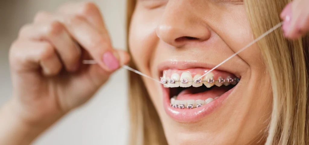 Orthodontie de l'adulte avec le Dr Romy Benguigui à Vitrolles