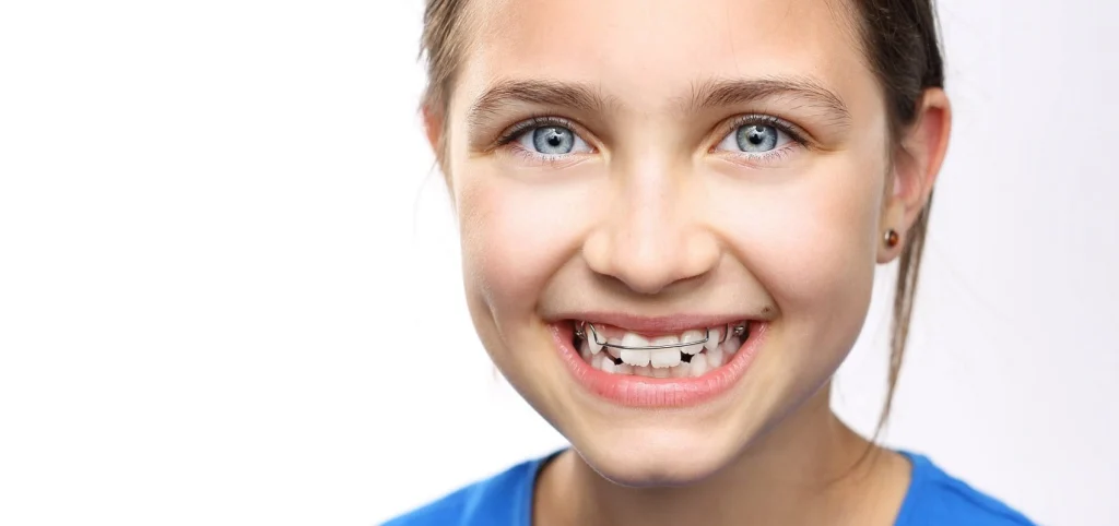 Orthodontie pour enfants : pourquoi consulter tôt ?